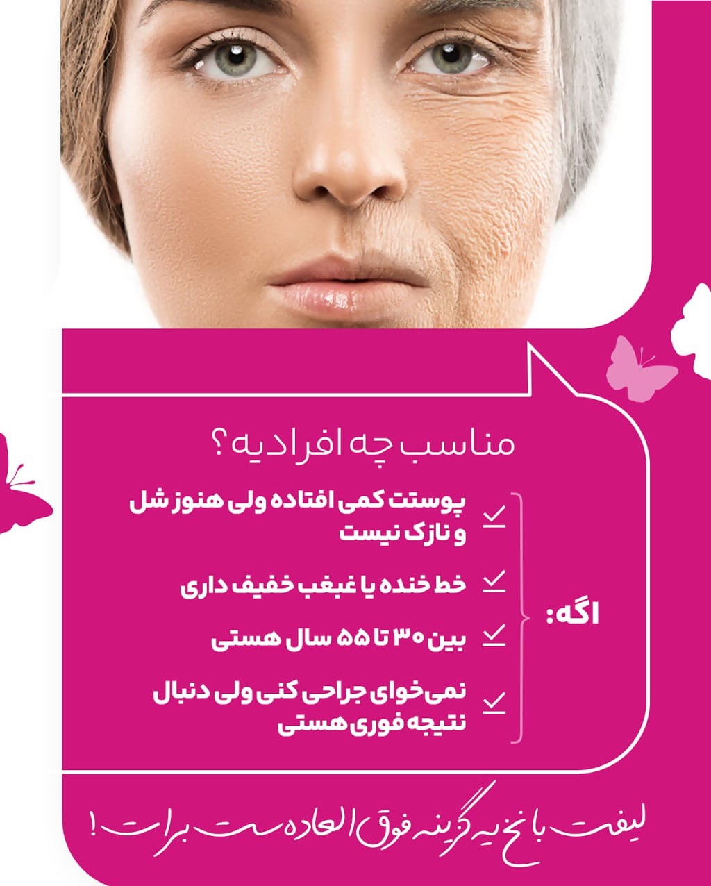 لیفت صورت مناسب چه کسانی است؟